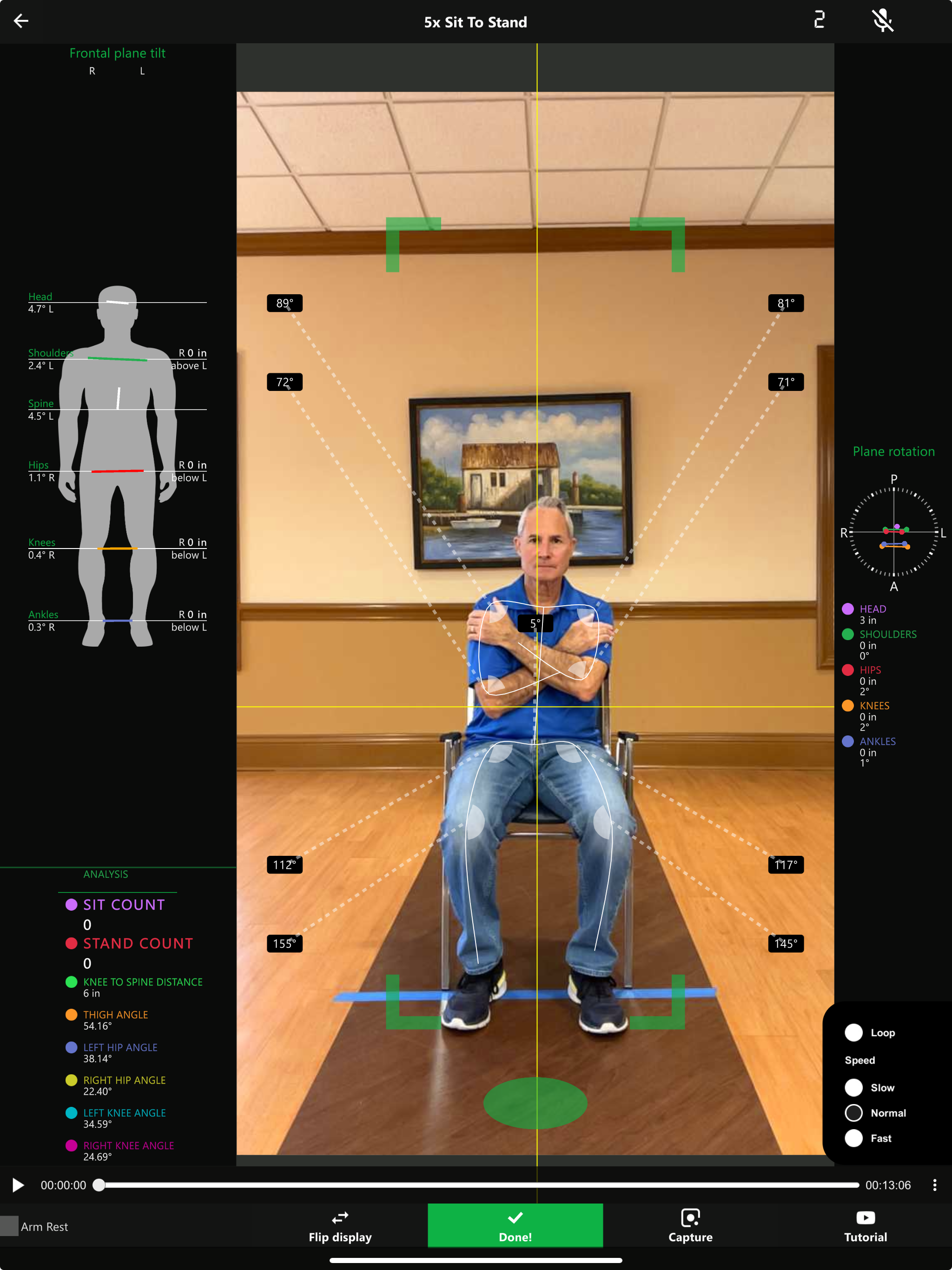 Movement screening technology